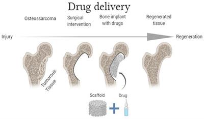 Calcium Phosphate-Based Bioceramics in the Treatment of Osteosarcoma: Drug Delivery Composites and Magnetic Hyperthermia Agents